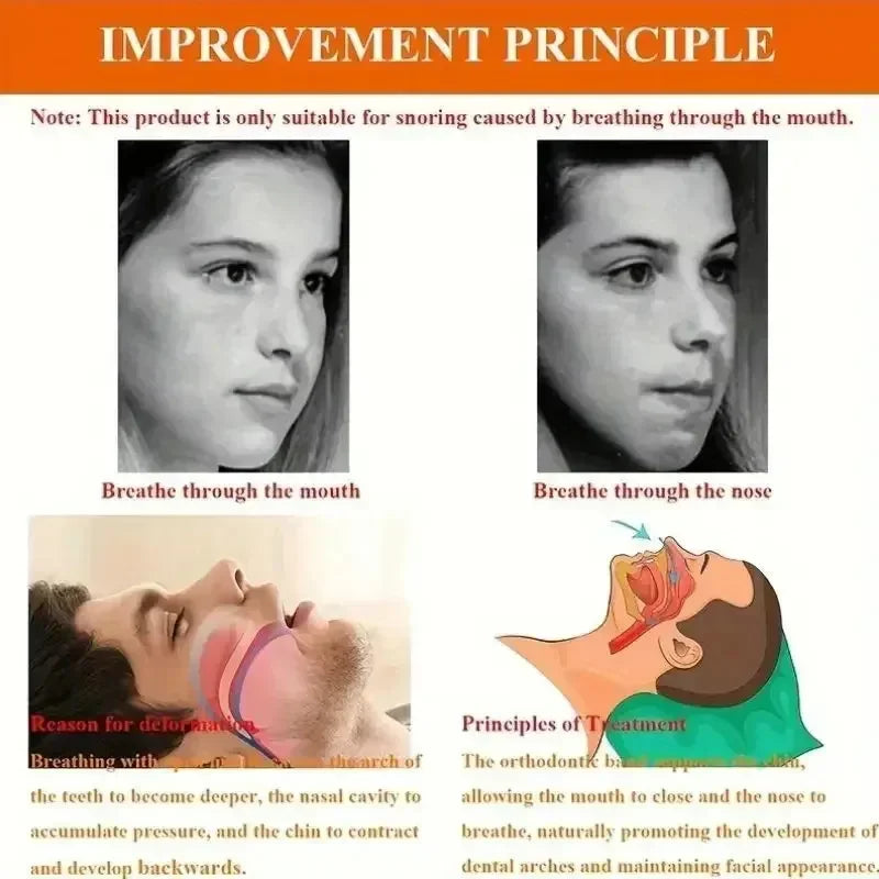 Anti-snoring Band, Open Mouth Breathing, Corrective, Chin Rest