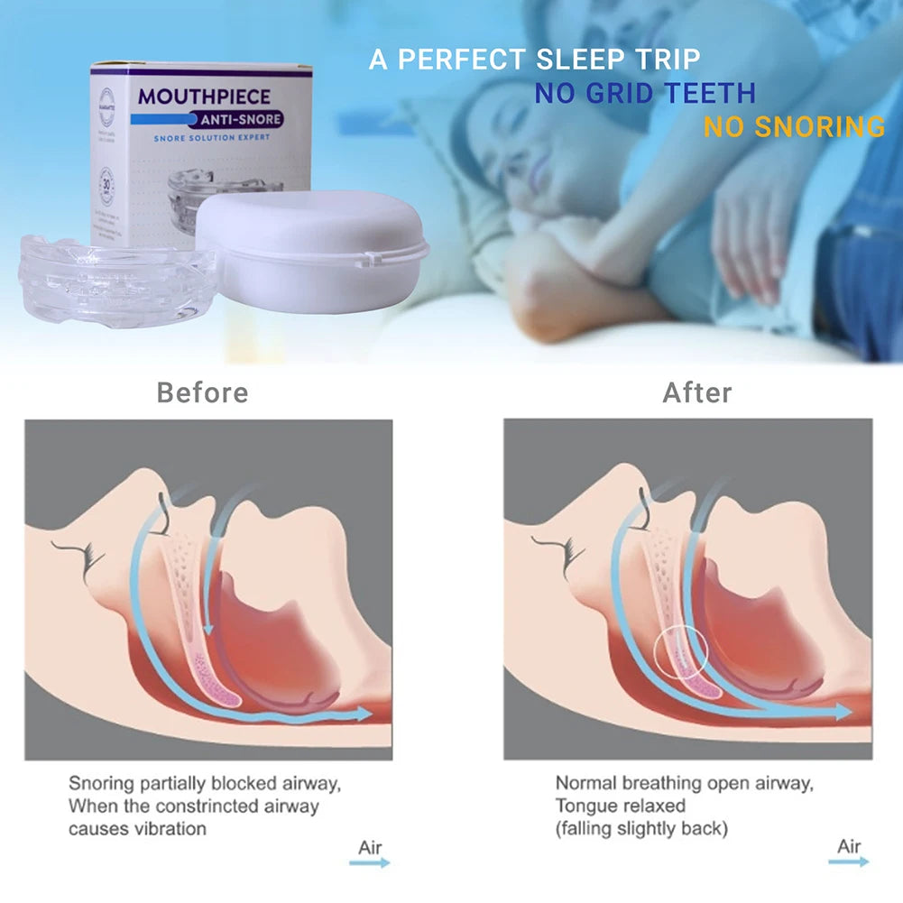 Portable Anti Snore Mouth Guard, Storage Box, Teeth Grinding Splint, Better Sleep Quality