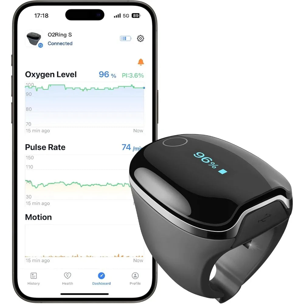 Oxygen Monitor Ring with Vibration Reminder, Bluetooth Pulse Oximeter Tracks SPO2 and Pulse Rate